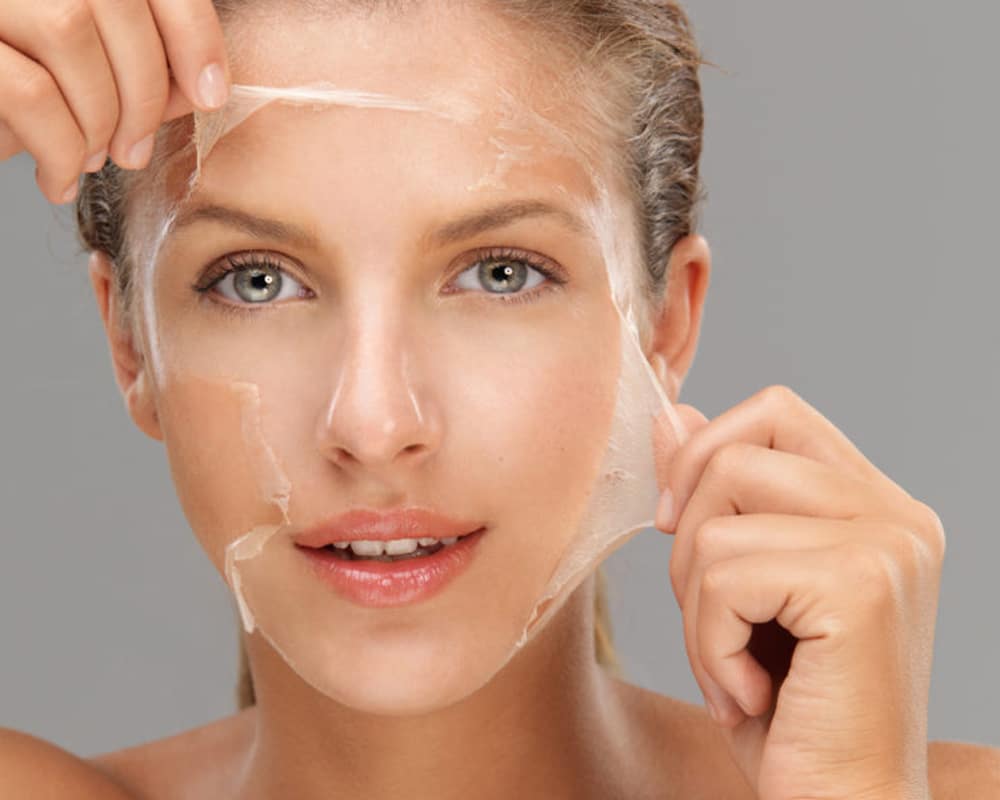 how to get rid of body acne scars